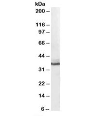 Anti-AKR1C4