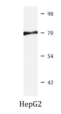 Anti-IDS / Iduronate 2 Sulfatase