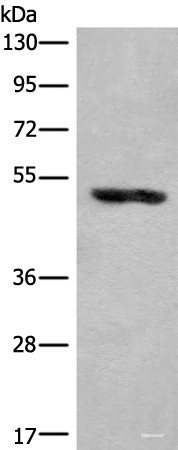 Anti-KLHDC2