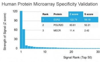Anti-Estrogen Receptor beta, clone ESR2/3207
