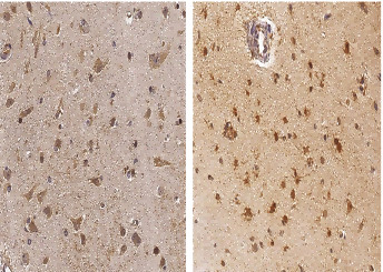 Anti-NGF/NGFB Monoclonal Recombinant Antibody