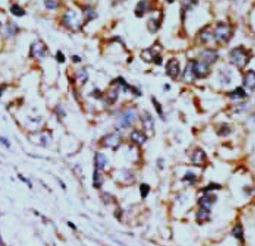 Anti-Connexin 36