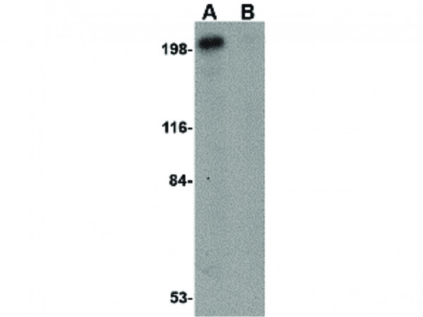 Anti-Integrin alpha 4