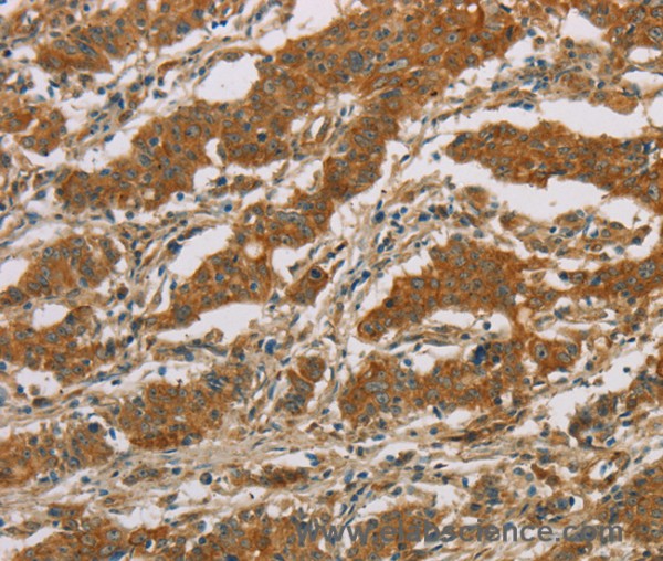 Anti-CYP39A1