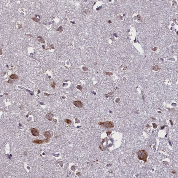 Anti-KCNE5