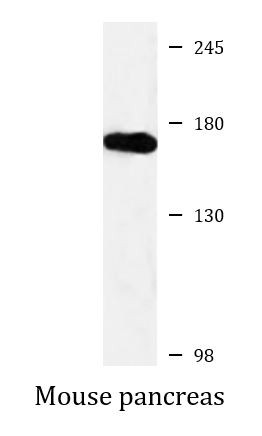 Anti-CD66e / CEA