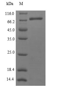 Methionine aminopeptidase 2 (METAP2), human, recombinant
