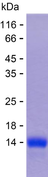 Recombinant Human UGT3A1 Protein