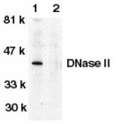 Anti-DNase II