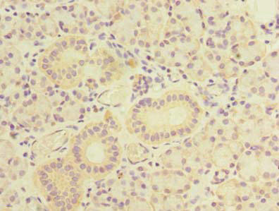 Anti-TBC1D9B