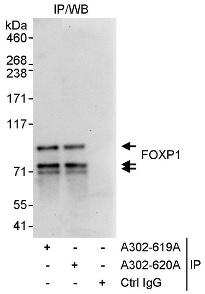 Anti-FOXP1