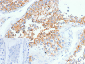 Anti-SPARC / Secreted protein acidic and cysteine rich, clone rOSTN/9835