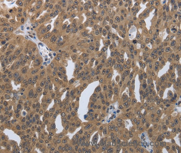 Anti-PRKAR1B