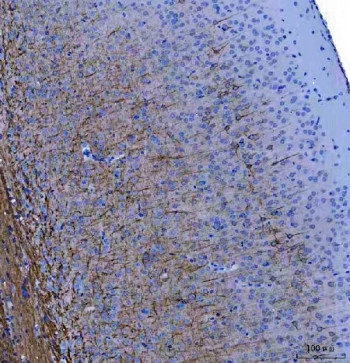 Anti-Neurofilament (Light), clone NR4