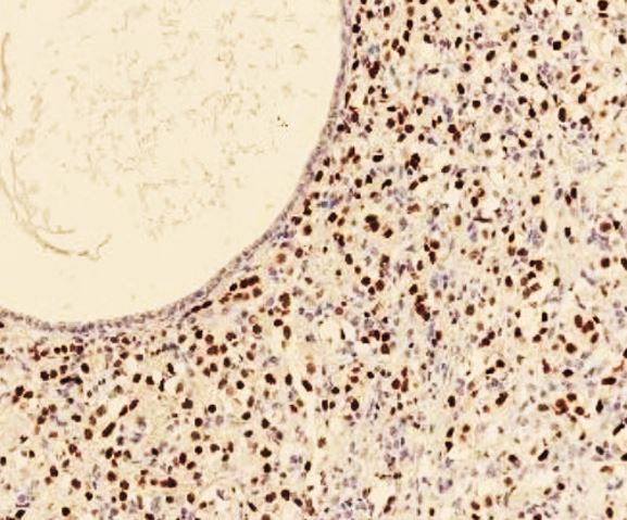 Anti-Myogenin, clone SQab20208