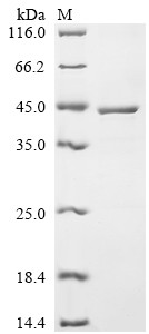 Estradiol 17-beta-dehydrogenase 1 (HSD17B1), human, recombinant