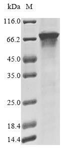 Terminal nucleotidyltransferase 4A (TENT4A), partial, human, recombinant