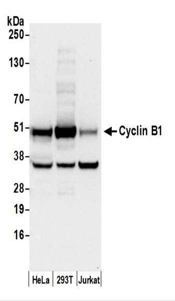 Anti-Cyclin B1/CCNB1