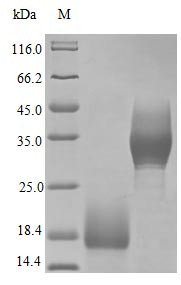 Trefoil factor 3 protein (TFF3) (Active), human, recombinant