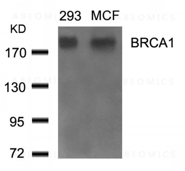 Anti-BRCA1 (Ab-1524)