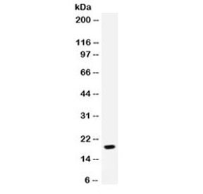Anti-NAP-2 / CXCL7