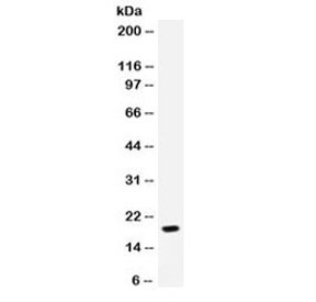 Anti-NAP-2 / CXCL7