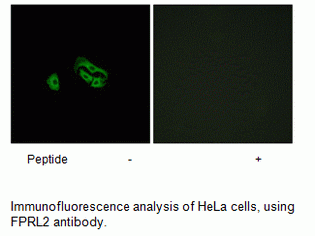 Anti-FPRL2