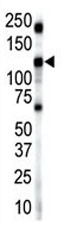 Anti-Insulin receptor-related