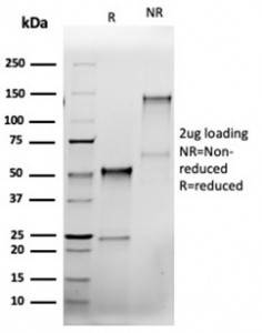 Anti-BCL2L1 / Bcl-X (recombinant antibody), clone rBCL2L1/4508