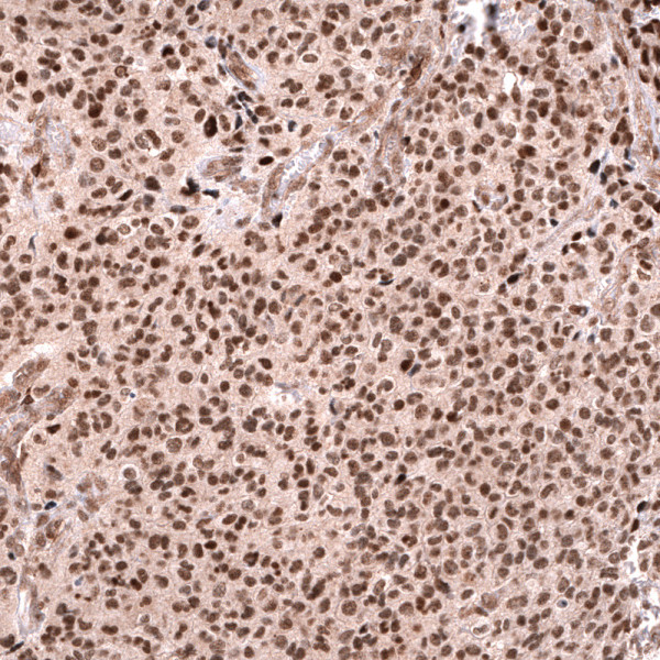 Anti-ABCB5, clone CL13603