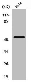 Anti-PFKFB1/PFKFB4