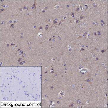 Anti-HMGCR