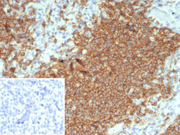 Anti-CD20 / MS4A1 (B-Cell Marker), recombinant antibody, clone rMS4A1/8044