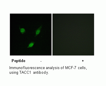 Anti-TACC1