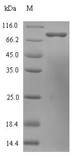 Histidine decarboxylase (HDC), human, recombinant