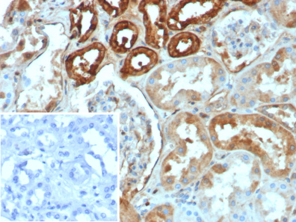 Anti-Calbindin 1 (CALB1), recombinant antibody, clone rCALB1/8499