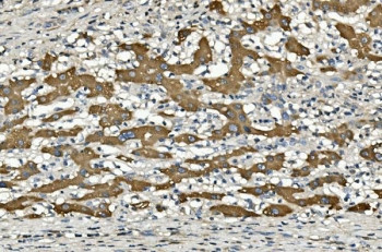 Anti-CYP2C19 / Cytochrome p450 2C19, clone 5G4