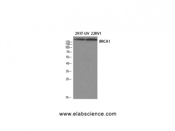Anti-BRCA1