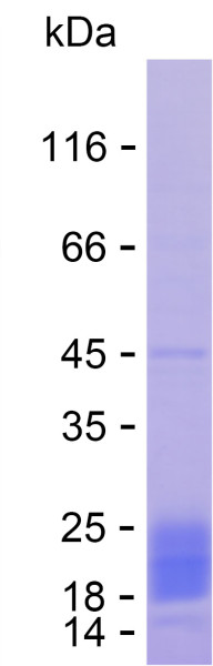Recombinant Human CSN4 Protein