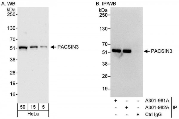 Anti-PACSIN3