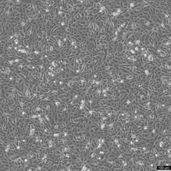 SNU-449 Cells