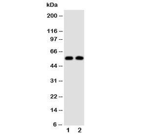 Anti-Alpha Amylase 1