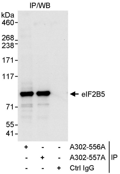 Anti-eIF2B5