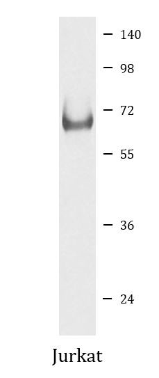 Anti-Lamin B Receptor