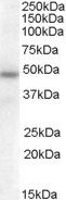 Anti-SERPINA12, Internal