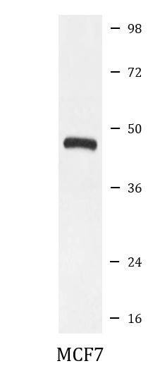 Anti-HDAC11