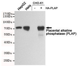 Anti-Alkaline phosphatase (placental), clone 8A11-C11-C9