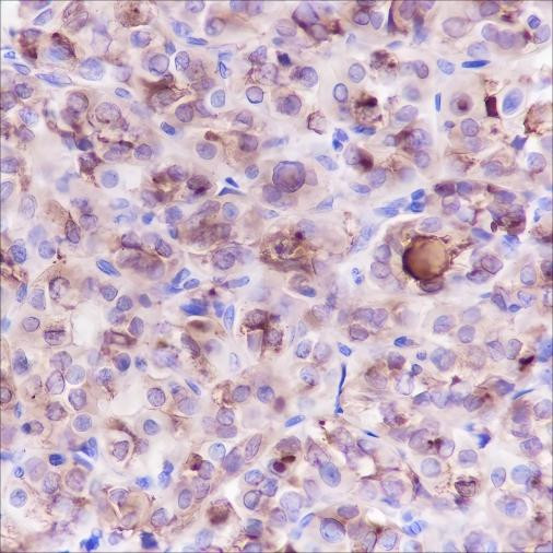 Anti-Recombinant Thyroglobulin, clone A378