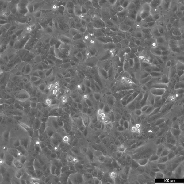 SUM149PT Cells