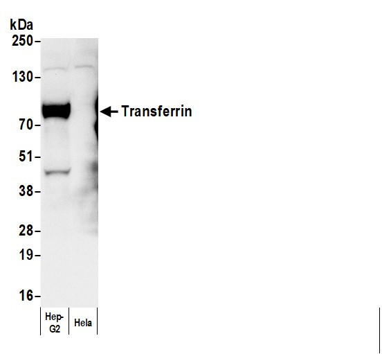 Anti-Human Transferrin, Biotin conjugated